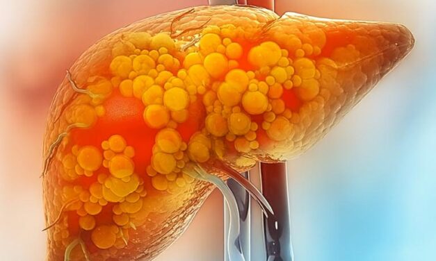 مصنوعی مٹھاس سوربٹول سے جگر کو خطرناک نقصان