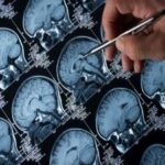 الزائمر جین: بیماری کے 90 فیصد کیسز کی بڑی وجہ